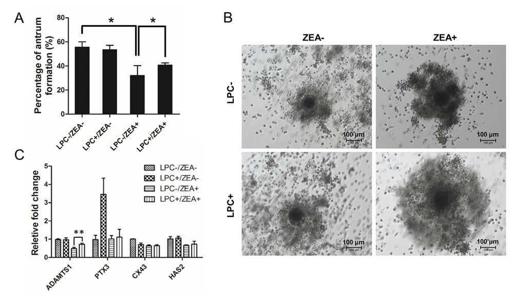 The effect of LPC co-treated ZEA on the follicular antrum formation andcumulus cell (CC) expansion. (A) The effect of supplementary 10 µg/mL LPC on the formation of follicular antrum of 10 µM ZEA treated OGCs after 12 d culture. (B) Morphology of CC expansion status in 10 µg/mL LPC and 10 µM ZEA co-treated conditions. (C) The effect of supplementary10 µg/mL LPC on CC expansion related gene expression of 10 µM ZEA treated cumulus oocyte complex (COCs). * or ** mean P 