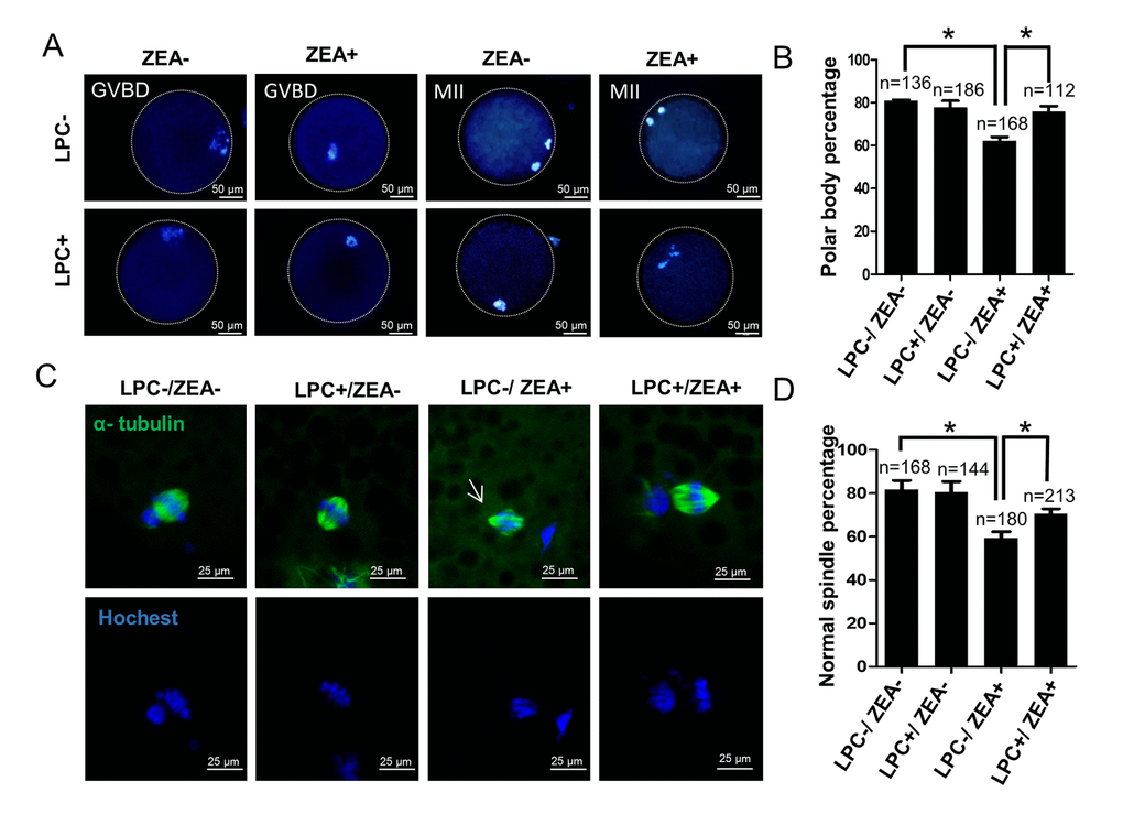 The effect of LPC co-treated ZEA on oocyte maturation. (A) The effect of 10 µg/mL LPC and 10 µM ZEA on oocyte maturation in vitro. (B) Polar body percentage of oocytes in 10 µg/mL LPC and 10 µM ZEA co-treated group. (C) The effect of 10 µg/mL LPC and 10 µM ZEA on the spindle assembly of oocytes, and the arrow shows the abnormal spindle assembly. (D) Normal spindle assembly percentage in 10 µg/mL LPC and 10 µM ZEA co-treated group. * means P 
