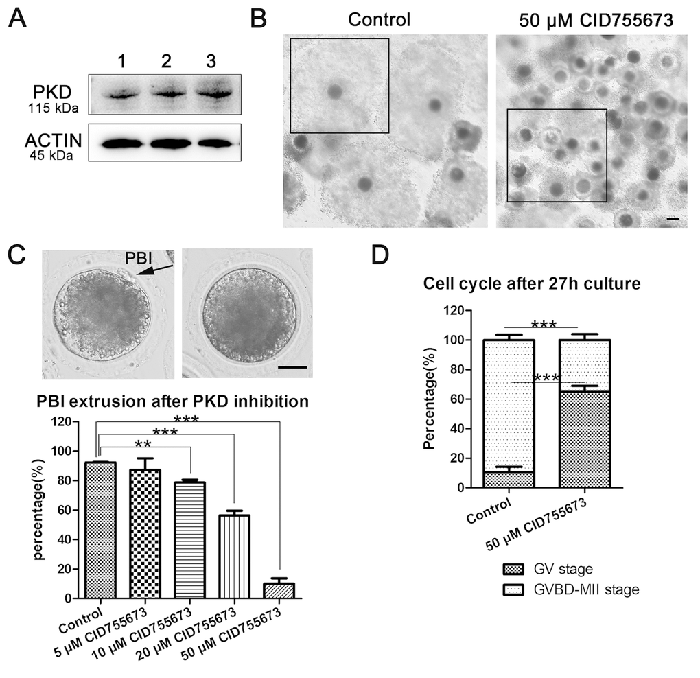 Inhibition Of Protein Kinase D Disrupts Spindle Formation And Actin 