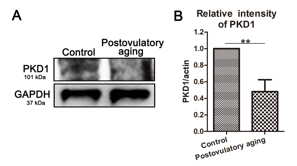 PKD1 expression decreases in aged oocytes. (A) Protein levels of PKD1 in control and postovulatory aging porcine oocytes were determined by western blotting. Rabbit polyclonal anti-PKD1 antibody was adopted. (B) Quantitative analysis of PKD1 expression in control and aging groups. Data are presented as mean ± s.d. from at least three independent experiments. **, significant difference (P 