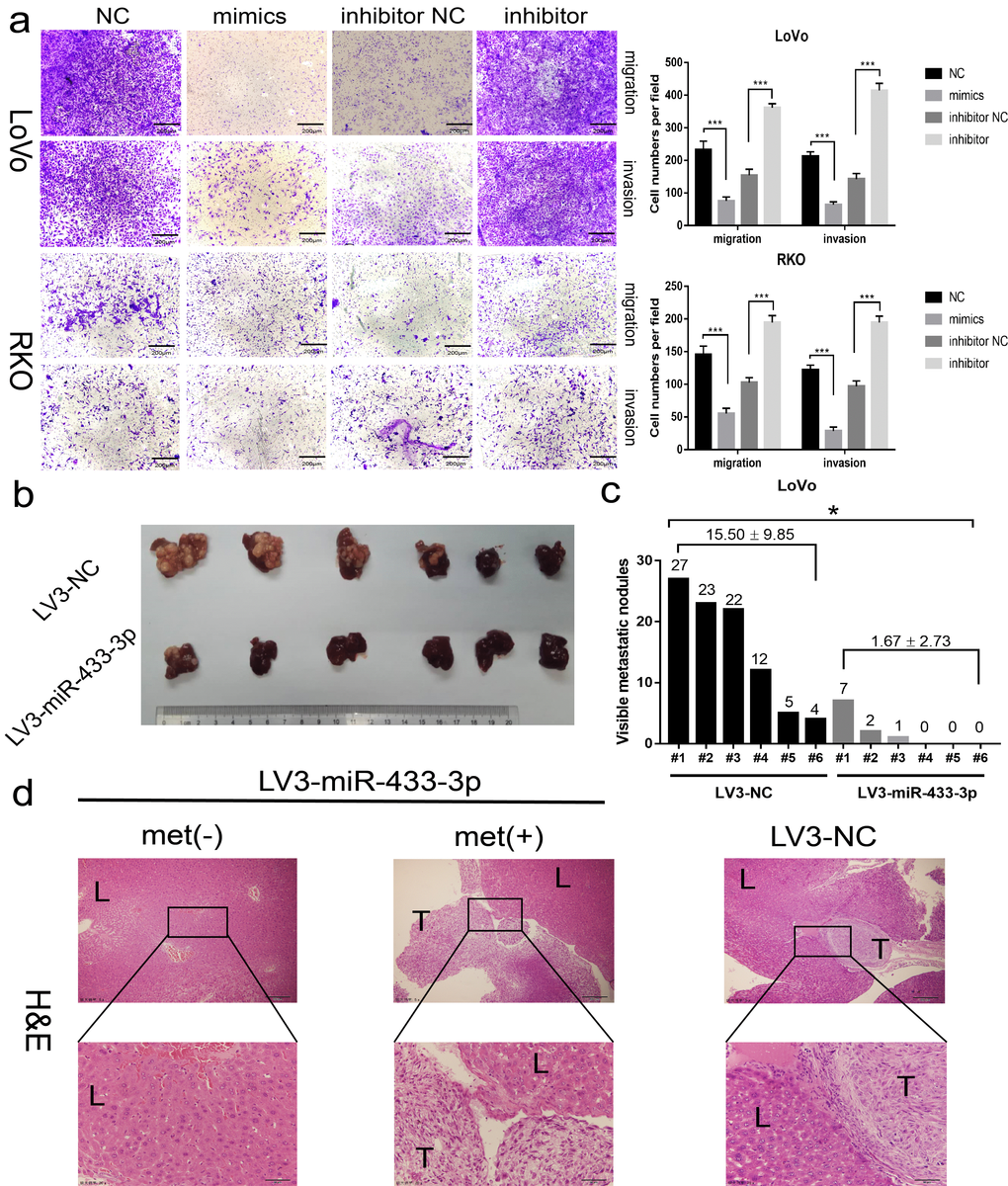 miR-433 attenuated the invasion and metastasis properties in CRC. (a) Transwell assays showed that restoration or downregulation of miR-433 by transfection of the mimics or inhibitor of miR-433 remarkably rescinded or reinforced the migration and invasion phenotype in LoVo and RKO cells (NC, negative control; mimics, miR-433 mimics; inhibitor NC, negative control for inhibitor; inhibitor, inhibitor of miR-433). (b) Four weeks after intra-splenic injection of LoVo/LV3-miR-433-3p and LoVo/LV3-NC cells, the livers of the two group mice were collected and photographed. (c) Corresponding visible metastatic nodules in the two groups showed that LV3-miR-433-3p conspicuously abolished the metastasis activity of LoVo cells. (d) H&E-stained livers with or without metastases were imaged (met(-), negatively metastatic mouse livers; met(+), positively metastatic mouse livers; T, metastatic tumor; L, liver). *, pp