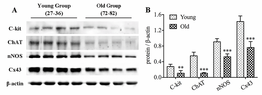 The decrease in protein expressions of c-kit, ChAT, nNOS and Cx43 in the colon of elderly humans. Expressions of c-kit, ChAT, nNOS and Cx43 proteins in colonic muscle layers detached from youth and older adults were examined by western blotting (n=4 per group), and similar reduction was observed (A-B). The densitometric analysis of protein expressions normalized to β-actin. Statistical analysis was performed using Student’s t-test and data were represented as mean ± SD, statistical significance is: ** P P 