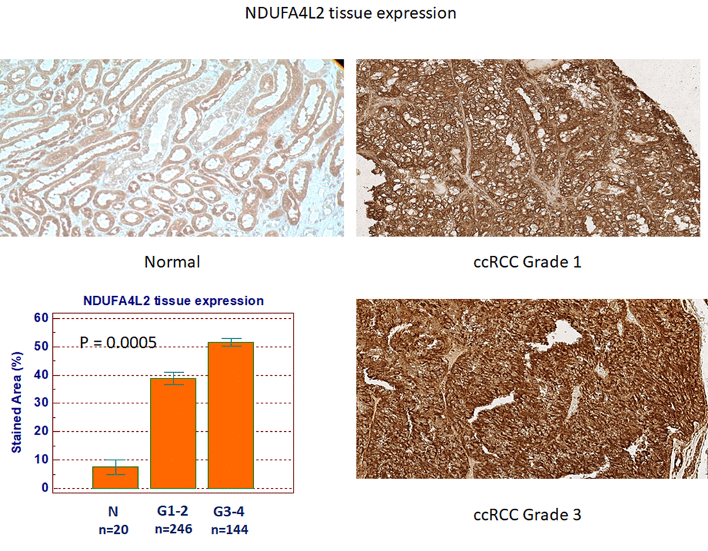 NDUFA4L2 expression in normal (n=20) and ccRCC (n=390) specimens.