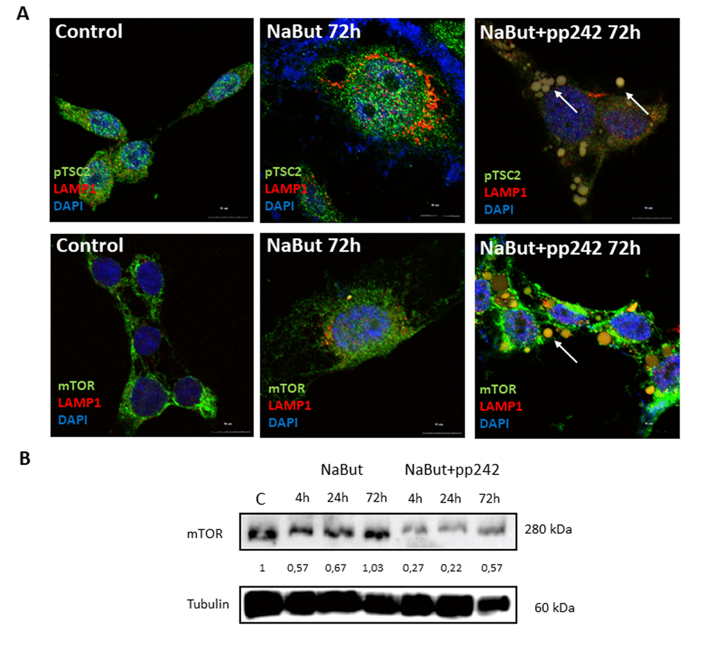 mTOR inhibition with pp242 uncouples mTOR from the lysosomes. (A) IF images showing pTSC2 (upper panel), mTOR (bottom panel) and lysosome (LAMP1) localization in senescent cells treated with pp242. Arrows show segregation of mTOR and pTSC2 (upper) and mTOR together with lysosomes (lower) in vacuoles and outside of cells. Nuclei stained with DAPI. (B) Western-blot analysis of mTOR levels in senescent cells after 72 h of pp242 treatment. The numbers represent densitometry of the bands.