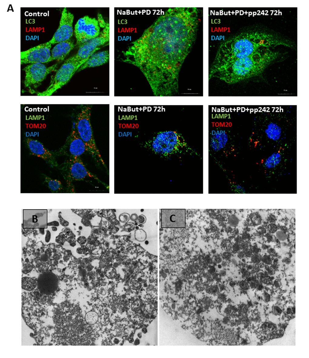 Senescent cells require active MEK/ERK pathway to implement degradation of the damaged mitochondria through their segregation into the LC3-negative vacuoles. (A) Cells exposed to MEK/ERK inhibitor do not segregate of lysosomes in the LC3-negative vacuoles (upper panel). IF images after staining with antibodies against LC3 and LAMP1) or mitochondria (bottom panel), IF images after staining with antibodies against TOM20 and LAMP1) of the LC3-negative vacuoles. (B) TEM of a senescent cell after MEK/ERK suppression undergoing complete destruction of the cytoplasm without segregation and elimination of the damaged mitochondria. (C) TEM image of senescent cells exposed to pp242 + PD0325901 showing destruction of the cytoplasm and dispersed damaged mitochondria. Scale bars: 1 µm.