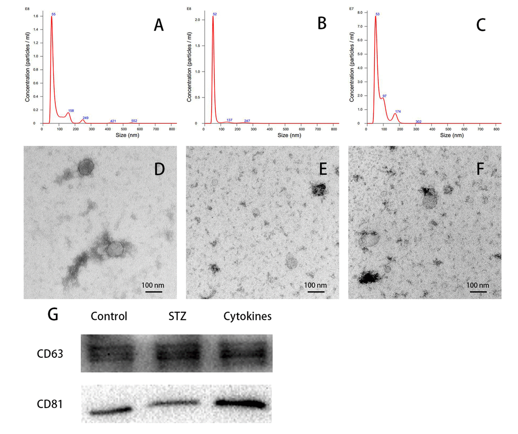 Characterization of islets-released exosomes. Exosomes derived from islets culture medium were characterized by NTA, TEM and western blot. (A-C) Particle and size distribution of analyzed derived from control, STZ and cytokines treated mouse islets were mostly within the normal range for exosome size (30-150 nm in diameter). (D-F) TEM of negatively staining showed the morphology of control, STZ and cytokines treated islet exosomes respectively. (G) Western blot analysis of CD63 and CD81 expression in exosomes.