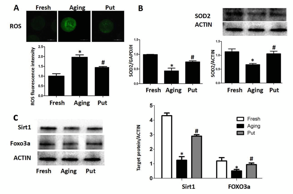 ROS accumulated in the aging oocytes and putrescine decreased ROS through the Sirt1-FOXO3a-SOD2 axis. (A) The accumulation of ROS in the oocytes during postovulatory aging. The level of ROS was significantly decreased in the putrescine-treated group. (B) The mRNA and protein expressions of SOD2. Both the mRNA and protein expressions of SOD2 were significantly decreased in the aging oocytes, while the expression of SOD2 was partially rescued by putrescine treatment. (C) The Sirt1-FOXO3a-SOD2 axis in the aging oocytes. The expressions of Sirt1, FOXO3a and SOD2 protein were significantly decreased in the postovulatory aging oocytes. Putrescine partially rescued the effects on the expressions of Sirt1, FOXO3a and SOD2 protein. Put, putrescine. Compared with the fresh MII oocytes, *pp