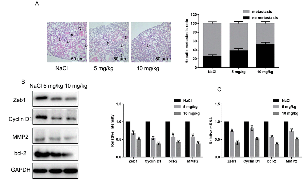 Naringin inhibits lung invasion by MG63 cells in vivo. (A) Representative images of lung histopathology (H&E staining; 400×) from mice injected with MG63 cells and treated daily with two different doses of naringin or NaCl (control) for 16 days. (B, C) Zeb1, Cyclin D1, bcl-2, and MMP2 expression in liver tumor samples, detected by Western blot (B) and real-time PCR (C). **P 
