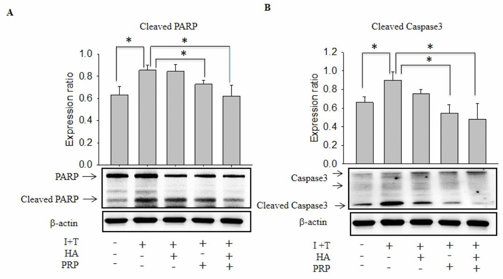 Effects of HA+PRP on inhibition of cellular apoptosis-related proteins in chondrocytes. Western blot analysis of (A) cleaved PARP and (B) cleaved caspase-3 after treatment of I+T conditioned medium in the presence of HA, PRP, and HA+PRP. *p