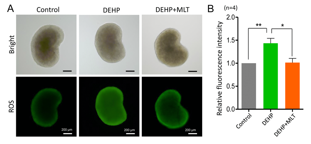 Effects of MLT on ROS generation in the fetal ovaries exposure to DEHP. (A) Representative images of DCHF-DA fluorescence (green) in the ovaries from the control, DEHP and DEHP+MLT groups. (B) Fluorescence intensity of ROS level. The results were presented as mean ± SEM. *P ** P 