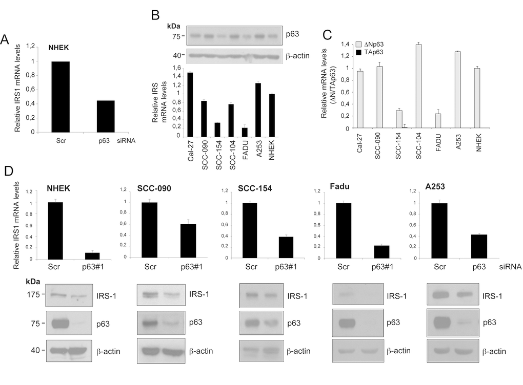 IRS1 expression is decreased upon down-regulation of p63 in HNSCC cell lines. (A) Relative expression levels of Irs1 as measured by RNA-Seq analysis of p63-depleted NHEK. Cells were transfected with p63 (sip63#1) or scrambled control (siScr) siRNAs. P-value = 0,005. (B) The amount of p63 was measured in NHEK and HNSCC cell lines by western blot analysis (upper panel). IRS1 transcript levels were analysed by RT-qPCR (lower panel). RT-qPCR was performed in duplicate. IRS1 expression was normalized on Tbp housekeeper and plotted relative to NHEK cells (mean ± s.d.). (C) The transcript levels of TAp63 (black box) and ΔNp63 (grey box) were measured in NHEK and HNSCC cell lines by RT-qPCR. RT-qPCR was performed as above. Gene expression was normalized on Tbp housekeeper and plotted relative to NHEK cells (mean ± s.d.). (D) RT-qPCR analysis (upper panels) of two independent experiments performed in duplicates for Irs1 transcripts in NHEK and HNSCC cells transfected with scrambled control (siScr) or p63 (sip63#1) siRNAs. Cells were harvested 48 h after transfection. qRT-PCR was performed as above. Values are normalized to Tbp and plotted relative to control cells (mean ± s.d.). Western blot analysis for IRS1 and p63 in HNSCC cells transfected as above. Cells were harvested 48 h after transfection. β-actin served as loading control.