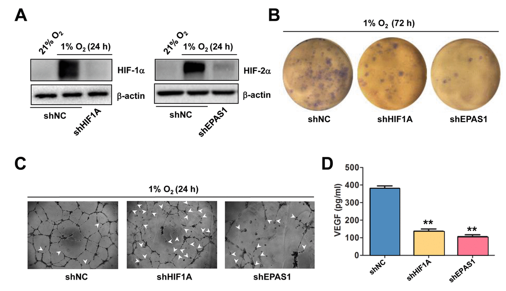 Knockdown of either HIF-1α or HIF-2α impairs hypoxia-induced angiogenesis and VEGF production in ECs. (A) HUVECs were transfected with pLKO.1 constructs encoding shRNA specifically targeting HIF-1α and HIF-2α, as well as scramble sequence as negative control (shNC). As the basal levels of HIF-1α or HIF-2α in HUVECs were relatively low, these transfected cells were exposed to 1% O2 (21% O2 as normoxia control) for 24 hrs, after which Western blot analysis was performed to confirm shRNA knockdown of HIF-1α and HIF-2α, respectively. (B, C) HUVECs expressing HIF-1α or HIF-2α shRNA were then exposed to 1% O2 for the indicated intervals, followed by colony formation assay (B, 72 hrs) and Matrigel-based tube formation assay (C, 24 hrs). Representative microscopic images for at least three independent experiments were shown. Arrowheads indicate unclosed loops of vascular structure. (D) In parallel, the VEGF level was measured by ELISA assay after cultured for 72 hrs under 1% O2. Values represent the means ± SD for at least three independent experiments performed in triplicate. **P 