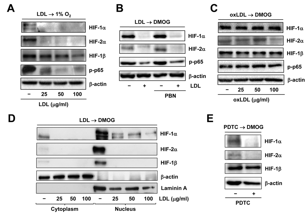 Native LDL, but not oxLDL, inhibits activation of HIF and NF−κB signals induced by hypoxia. HUVECs were treated as follows: (A) pre-treated with LDL (100 μg/ml) for 48 hrs, followed by incubation under hypoxic (1% O2) condition for additional 48 hrs; (B) pre-treated with LDL (100 μg/ml) in the presence or absence of the free radical scavenger PBN (2 mM) for 48 hrs, and then exposed to the PHD inhibitor DMOG (1 μM) for additional 72 hrs; (C) pre-treated with the indicated concentrations of oxidized LDL (oxLDL, μg/ml) for 48 hrs, followed by DMOG (1 μM) for additional 72 hrs. After treatment, Western blot analysis was performed to monitor expression of HIF-1α, HIF-2α, and HIF-1β, as well as phosphorylation of NF-κB p65 (S536). (D) Alternatively, HUVECs were treated as described in panel 4B, after which cytoplasmic and nuclear fractions were separated and subjected to Western blot analysis for monitoring nuclear translocation of HIF-1α, HIF-2α, and HIF-1β. Blots were reprobed for β-actin and laminin A as loading controls for cytoplasmic and nuclear fractions, respectively. (E) HUVECs were pre-incubated with the NF-κB inhibitor PDTC (100 μM) for 4 hrs, followed by DMOG (1 μM) for additional 72 hrs, after which the protein levels of HIFs were monitored by Western blot analysis.