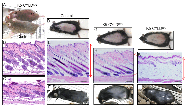 Analysis of the hair regrowth in Control and K5-CYLDC/S mice. (A) Representative image of the patches of diffuse alopecia (arrows) of the transgenic mice (7-month-old mice are shown). (B, C) Representative images of the skin of 1-month-old mice. (D-L) Representative images of a hair growth experiment. The back of 7-week-old mice was shaved and the skin was collected 16 days after depilation. (D-F) Hair regrowth in Control mice. (G-L) Hair regrowth in the K5-CYLDC/S mice. (D, G, J) Representative images of freshly depilated mice of the corresponding phenotypes (day 0 of the experiment). (E, F) 16 days after shaving Control HFs were in the anagen-catagen I phase (E) and mice exhibited a homogeneous hair regrowth (F). (H) Histology showing initiation of the anagen phase of the hair cycle 16 days after shaving the back of a transgenic mouse. The macroscopic view of this mouse showed that hair was very short and hardly visible (I). (K) Histology of a section of the back skin of a K5-CYLDC/S mouse showing a delay in the growth of the new hair, so that 16 days after shaving it still remains in the telogen phase. (L) Macroscopically these areas correspond to those lacking hair in the back skin of the transgenic mouse (white asterisks). Red arrows show differences in the thickness of the skin between Control (E) and transgenic mice (H, K). Scale bars: 280 μm.