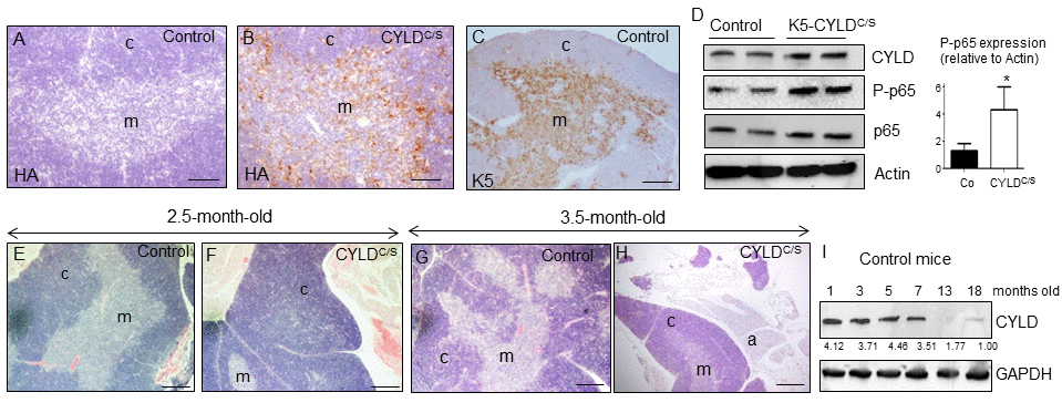 Premature thymic involution and over-activation of NF-κB in the thymus of K5-CYLDC/S mice. (A-C) Analysis of the expression of the transgene by immunostaining with a specific antibody against the HA tag. Expression of HA is detected in the medulla of the thymus of the K5-CYLDC/S mice (B), following the expression pattern of the K5 (C), while it is not detected in the Controls (A). (D) Analysis by WB of the expression of the transgene in protein extracts from isolated thymic cells of mice of 3.5-month-old. Note the overactivation of NF-κB (increased levels of P-p65) in the K5-CYLDC/S mice. Mann-Whitney U test was used for statistical analysis. (*pE, F) Histological analysis of the thymus of 2.5-month-old mice. Observe the expansion of the cortical zone and reduction of the medullar region in the thymus of transgenic mice (F). (G, H) H&E staining of 3.5-month-old Control (G) and K5-CYLDC/S mice (H) thymus. A representative image of the thymic atrophy and infiltration of white adipose tissue in the thymus of transgenic mice (H) is shown. (I) Western blot showing the decreased expression of CYLD with age in the thymus of control mice. M, medulla. C, cortex. a, adipose tissue. Scale bars: 200 μm (A, B); 300 μm (C); 350 μm (E-H).
