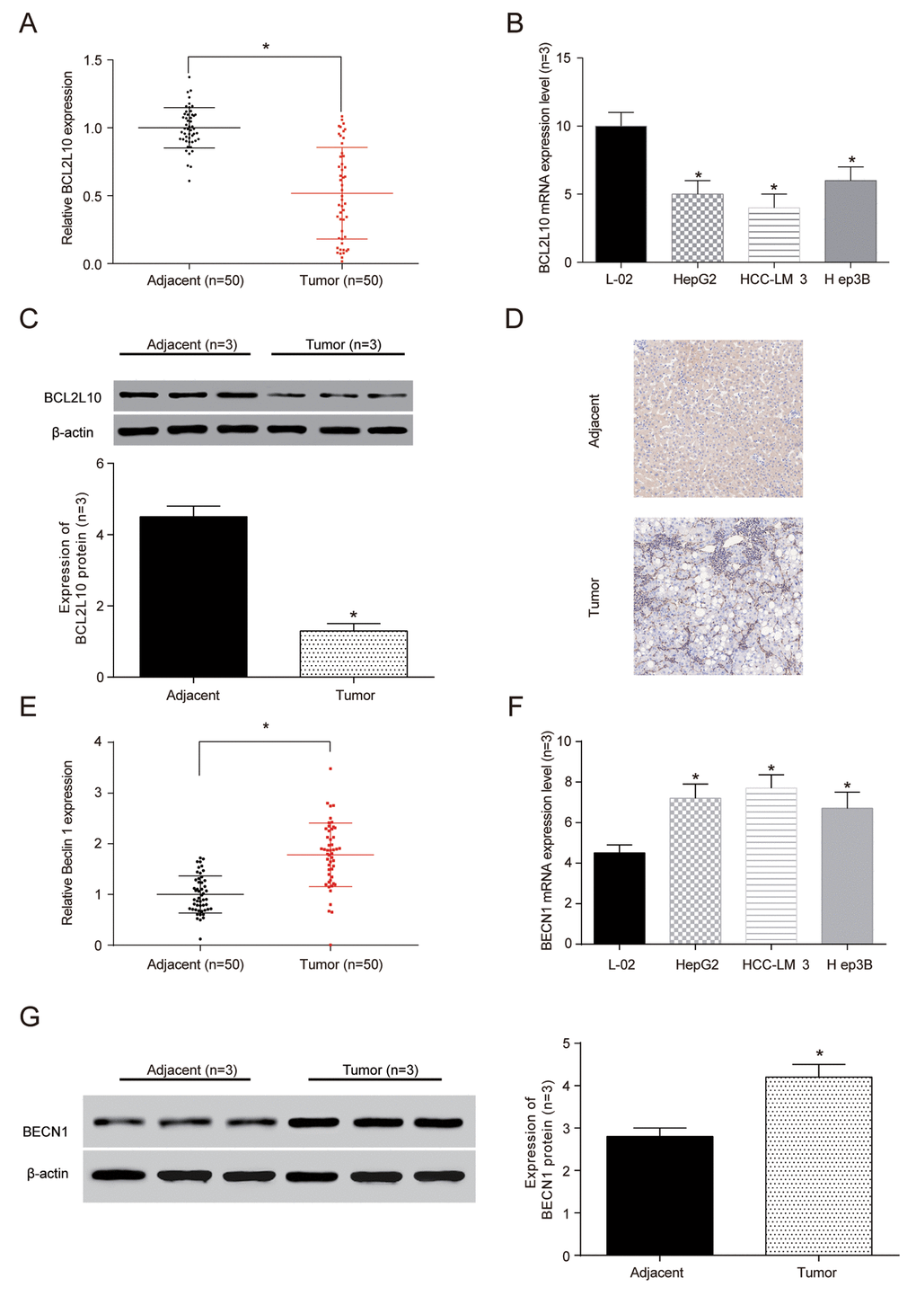 The expression ofBCL2L10 was low in hepatocellular carcinoma (HCC) tissues and cells. (A) The expression of BCL2L10 mRNA in HCC detected by qRT-PCR. (B) The expression of BCL2L10 in L-02 normal liver cells and 3 groups of hepatoma cells detected by qRT-PCR. (C) Western Blot showed the low expression of BCL2L10 in HCC tissues. (D) Immunohistochemistry showed that the normal liver tissues had more brown granules than HCC tissues (× 40). * PE) The expression of BECN1 mRNA in L-02 normal liver cells and 3 groups of hepatoma cells detected by qRT-PCR. (F) The expression of BECN1 in L-02 normal liver cells and 3 groups of hepatoma cells detected by qRT-PCR. (G) Western Blot showed the low expression of BECN1 in HCC tissues.