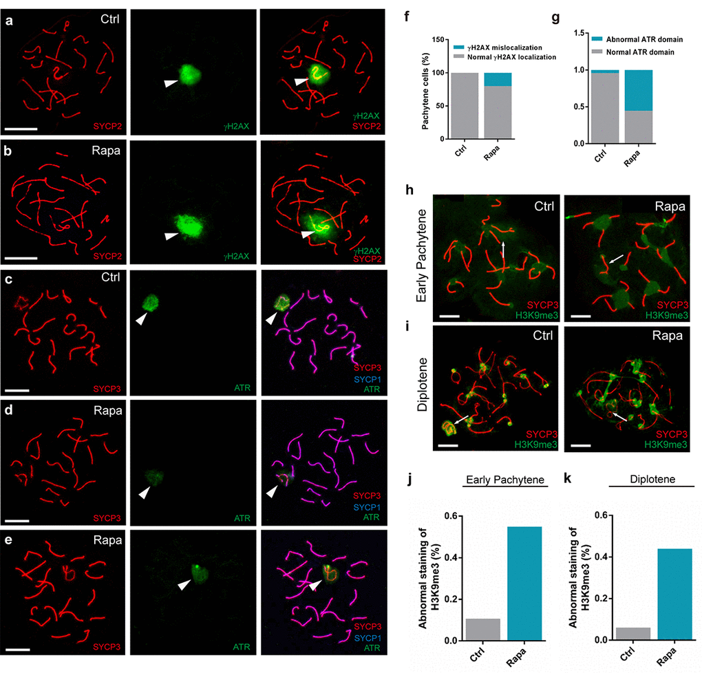 Abnormal localization of sex body silencing factors in pachytene spermatocytes from rapamycin-treated mice. Immunostaining of spread nuclei for SYCP3 (red) and silencing factors (green). (a) Control pachynema with restriction of γH2AX signal to the sex chromatin. (b) Pachynema from rapamycin-treated mice with γH2AX signal in autosomal regions (spermatocytes analyzed: Control, n=210; Rapamycin, n=250. χ2 test). White arrowheads indicate the sex chromosomes. (c-e) Localization of ATR to sex body and chromosomal axes in control spermatocytes (c) contrasting with weak ATR staining to the sex body in spermatocytes from rapamycin-treated mice (d-e). White arrowheads indicate the sex chromosomes. (f, g) Percentage of pachytene spermatocytes with abnormal localization of γH2AX or ATR. (h, i) Immunostaining for H3K9me3 in early pachytene stage (h) and diplotene stage (i) spermatocytes from control and rapamycin-treated mice. White arrows mark the sex chromosomes. (j, k) Quantification of spermatocytes with defects in H3K9me3 localization at the early pachytene stage (j) and diplotene stage (k). Scale bar, 10μm.