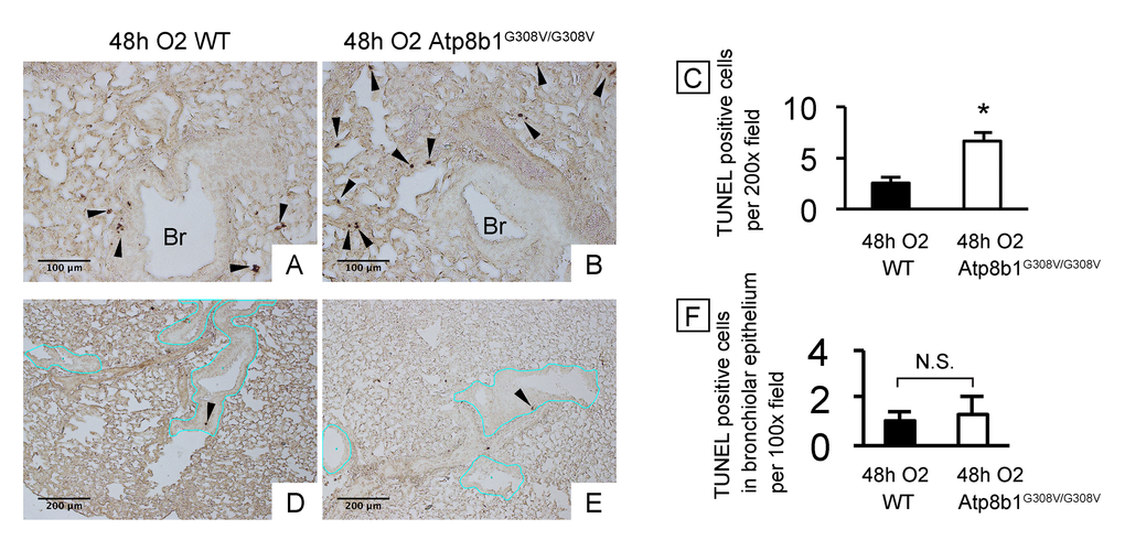 Atp8b1G308V/G308V mice under hyperoxic conditions display increased cell death in alveoli, but not in bronchiolar epithelium. Wild-type (WT) and Atp8b1G308V/G308V mice were exposed to 100% O2 for 48 hrs. Mice were euthanized and formaldehyde fixed paraffin-embedded lung sections were stained with terminal deoxynucleotidyl transferase dUTP nick end labeling (TUNEL). TUNEL-positive cells are denoted by arrowheads. (A & B) Representative photomicrographs focusing on bronchovascular bundles with surrounding alveoli. (C) Quantitative comparison between hyperoxic WT and Atp8b1G308V/G308V mice (n=3 for each) regarding the total number of TUNEL positive cells per 100x field in the lung. The numbers of TUNEL-positive cells were determined in 7-8 randomly chosen 100x fields for each section. Means ± SE for each group is shown. *p D & E) Representative photomicrographs of peripheral part of the lung with relatively small bronchioles. Basement membranes of bronchiolar epithelium are highlighted by blue lines. (F) Quantitative comparison between hyperoxic WT and Atp8b1G308V/G308V mice (n=3 for each) regarding the number of TUNEL positive cells in bronchiolar epithelium. The number of TUNEL-positive cells in bronchiolar epithelium were determined in 7-8 randomly chosen 100x fields. Means ± SE is shown. *p 