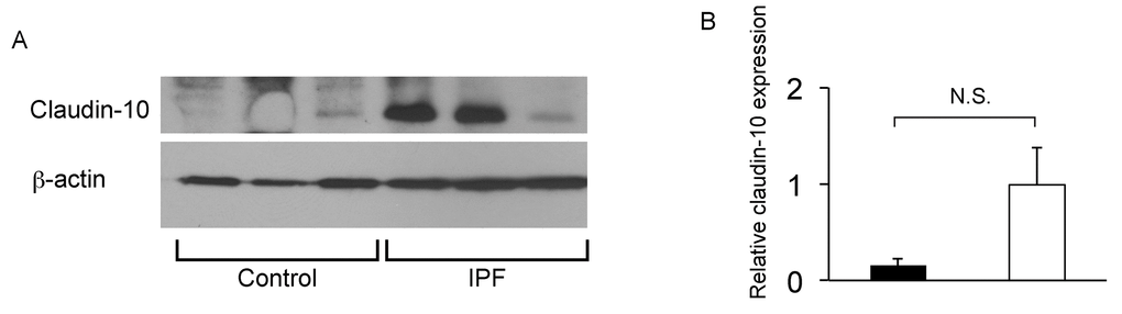IPF lungs show increased claudin-10 expression. (A) Western Blot analysis was performed using whole protein lysates from IPF and control lung samples (n=3 for each), to determine relative abundance of claudin-10. Equal amounts of protein (50μg) were loaded per lane. Data presented are representative of two independent experiments. (B) Expression of claudin-10 in A was normalized to β-actin and presented in arbitrary units.
