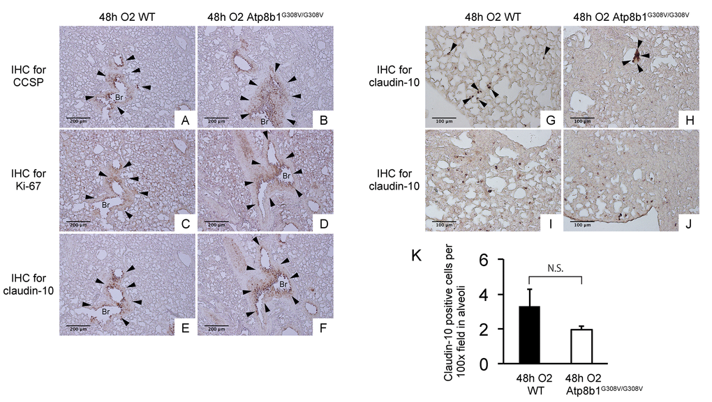 Atp8b1G308V/G308V mice under hyperoxic conditions display proliferation of claudin-10-positive club cells in thickened bronchiolar epithelium. Paraffin-embedded lung sections from WT and Atp8b1G308V/G308V mice exposed to 100% O2 for 48 hrs were subjected to immunohistochemical staining for club cell secretory protein (CCSP). (A & B), Ki-67 (C & D), and claudin-10 (E-J) (n=3 for each of WT and Atp8b1 mutant mice). Photomicrographs show representative images from either parabronchiolar (A-F) or alveolar regions (G-J) Arrowheads in Figure A-H designate positive cells for the respective markers. (K) claudin-10 positive cells per 100x field in alveoli were quantified in 10 randomized independent fields of 4 mice per each group. Means ± SE of the total number of claudin-10 positive cells for each group is shown. Br: Bronchiolar lumen. Magnifications: (A-F) 100X (G-J) 200X. Data presented are representative of two independent experiments.
