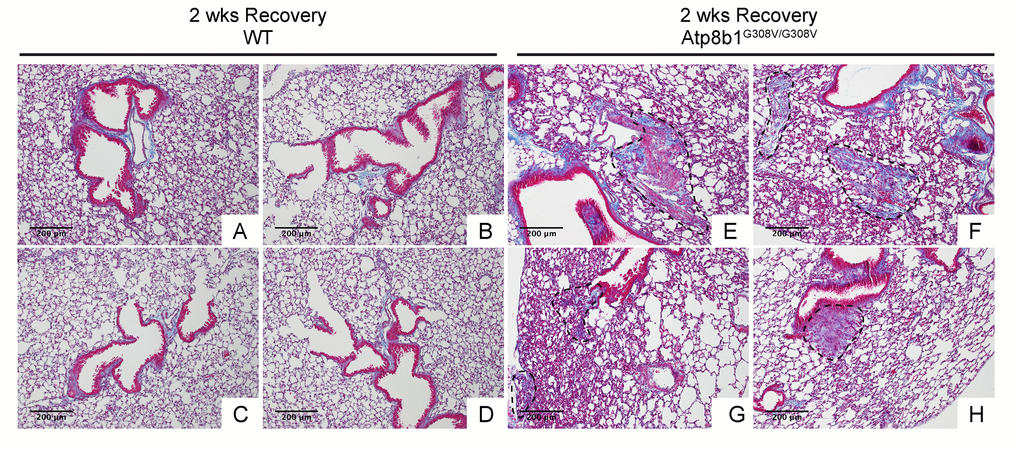 Atp8b1G308V/G308V mice exposed to hyperoxia and returned subsequently to normoxia for recovery display abnormal fibrotic reactions in the lung. Representative photomicrographs of Masson's Trichrome-stained lung sections from 7-9-wk-old WT (A-D) and Atp8b1G308V/G308V mice (E-H) that were exposed to 100% O2 for 48 hrs and allowed to recover under normoxia for 12 days (n=3 for each). WT mice show minimal collagen deposition mainly at peribronchiolar and perivascular areas. Atp8b1G308V/G308V mice show patchy distribution of aberrant collagen deposition (areas circled by dashed lines in Panel E, F, G & H): (Panel E) perivascular region, (Panel F) alveoli, (Panel G) alveoli located at subpleura and alveoli adjacent to alveolar duct, and (Panel H) peribronchiolar region. Magnification: (A-H) 100X. Data presented are representative of two independent experiments.