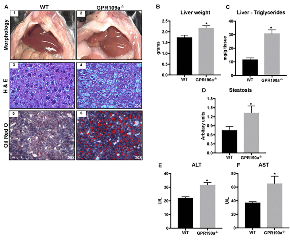 Absence of GPR109A induces age-associated hepatic steatosis in mice. (A) Morphological appearance (1-2), hematoxylin and eosin (3-4) and Oil red O staining of 12 month old WT and Gpr109a-/- mouse liver sections (20X) (5-6). (B) Changes in liver weight and (C) triglyceride content of 12-month-old WT and Gpr109a-/- mice. (D) Semi-quantitative scoring system was used to assess hepatocyte steatosis (0, 1-5% of total area; 1, 5 – 33% of the total area; 2, 33 – 66% of the total area; 3, >66% of the total area; results represented in arbitrary units. (E-F) Changes in the circulating levels of liver injury markers. Data is represented as mean ± S.E.M for (n=6). *p