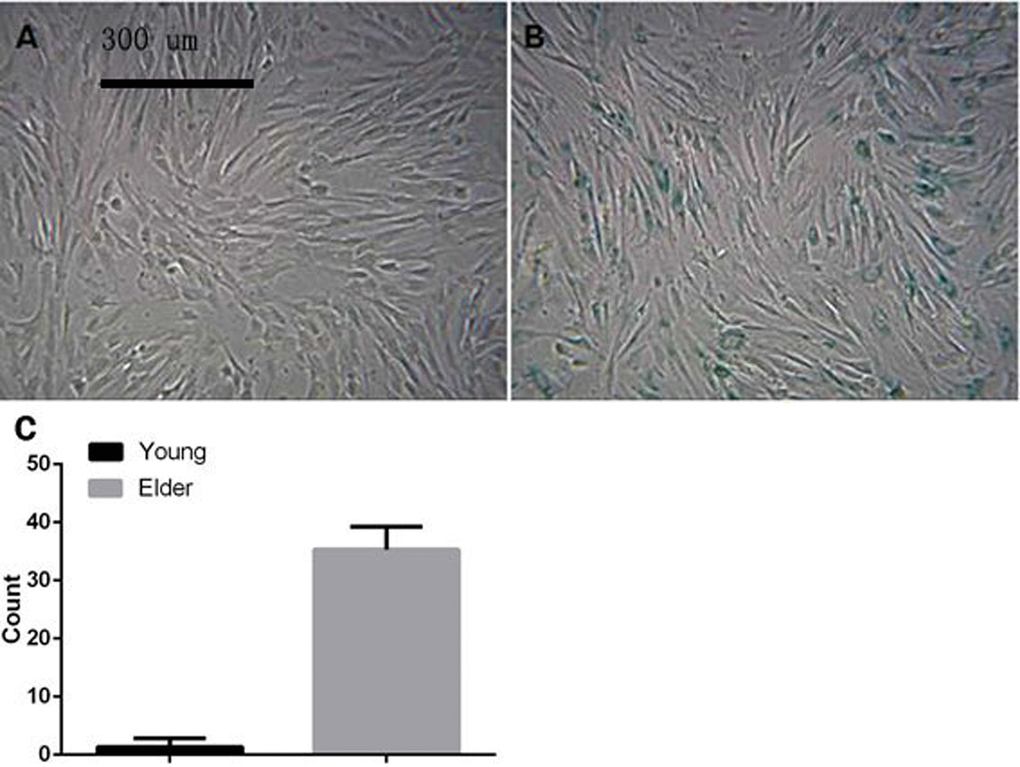 Macaque P3 BMSCs stained with senescence-associated SA-β-gal (A) and (B) show young macaque and aged macaque P3 BMSCs, respectively (×100)