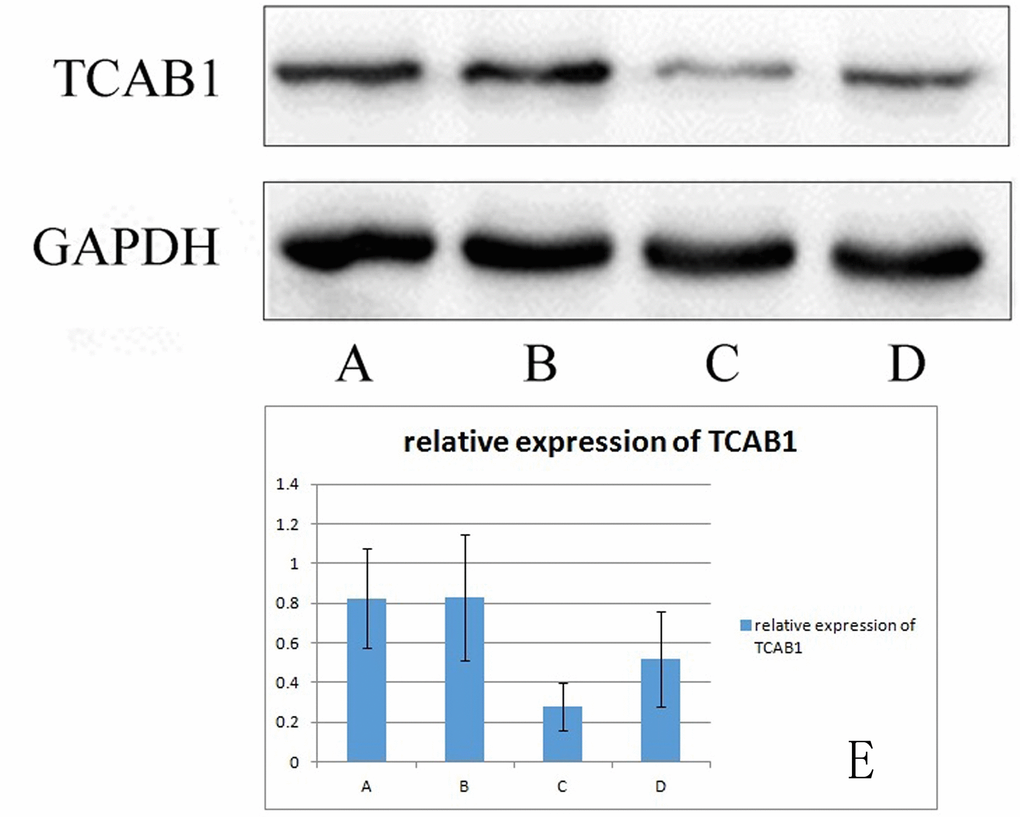Relative expression of TCAB1 in 293T cells