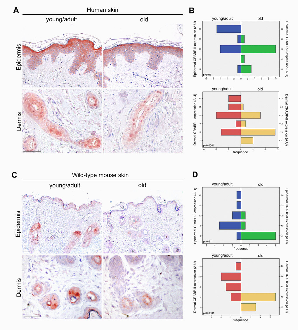 CRABP-II expression is reduced in aged human and mouse skin. (A) Representative images of CRABP-II immunostaining of human normal skin from young/adult and old donors. (B) Bar graphs show semiquantitative evaluation of human epidermal and dermal CRABP-II immunostaining (n=15 young/adult and n=15 old), respectively. (C) Representative images of CRABP-II immunostaining of young/adult and old wild-type mouse skin. (D) Bar graphs show semiquantitative evaluation of mouse epidermal and dermal CRABP-II immunostaining (n=10 young/adult and n=10 old WT). Scale bar: 50µm. Mann-Whitney’s U-test. Abbreviation: AU, arbitrary units.