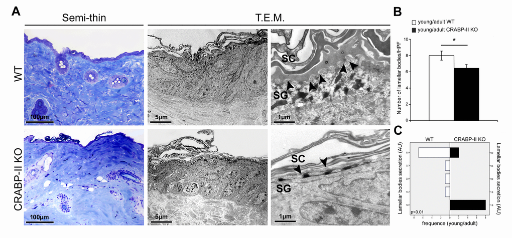 Ultrastructural evidence of age-related epidermal damage is early and greater in CRABP-II knock-out mice. (A) Representative images of toluidine blue-stained semithin EPON-embedded sections and transmission electron microscopy (T.E.M.) photographs of epidermis of young/adult wild-type (WT) and CRABP-II knock-out (KO) mice. (B) Bar graphs show the semiquantitative evaluation of ultrastructural epidermal number of lamellar bodies (n=10 young/adult WT and n=10 young/adult CRABP-II KO). Values are group mean ± SEM, t-Test: * indicates pC) Semiquantitative evaluation of ultrastructural epidermal secretion of lamellar bodies (n=10 young/adult WT and n=10 young/adult CRABP-II KO). Mann-Whitney’s U-test. Arrow heads indicate lamellar bodies. Abbreviations: SC, stratum corneum; SG, stratum granulosum; HPF, High Power Field; AU, arbitrary units.