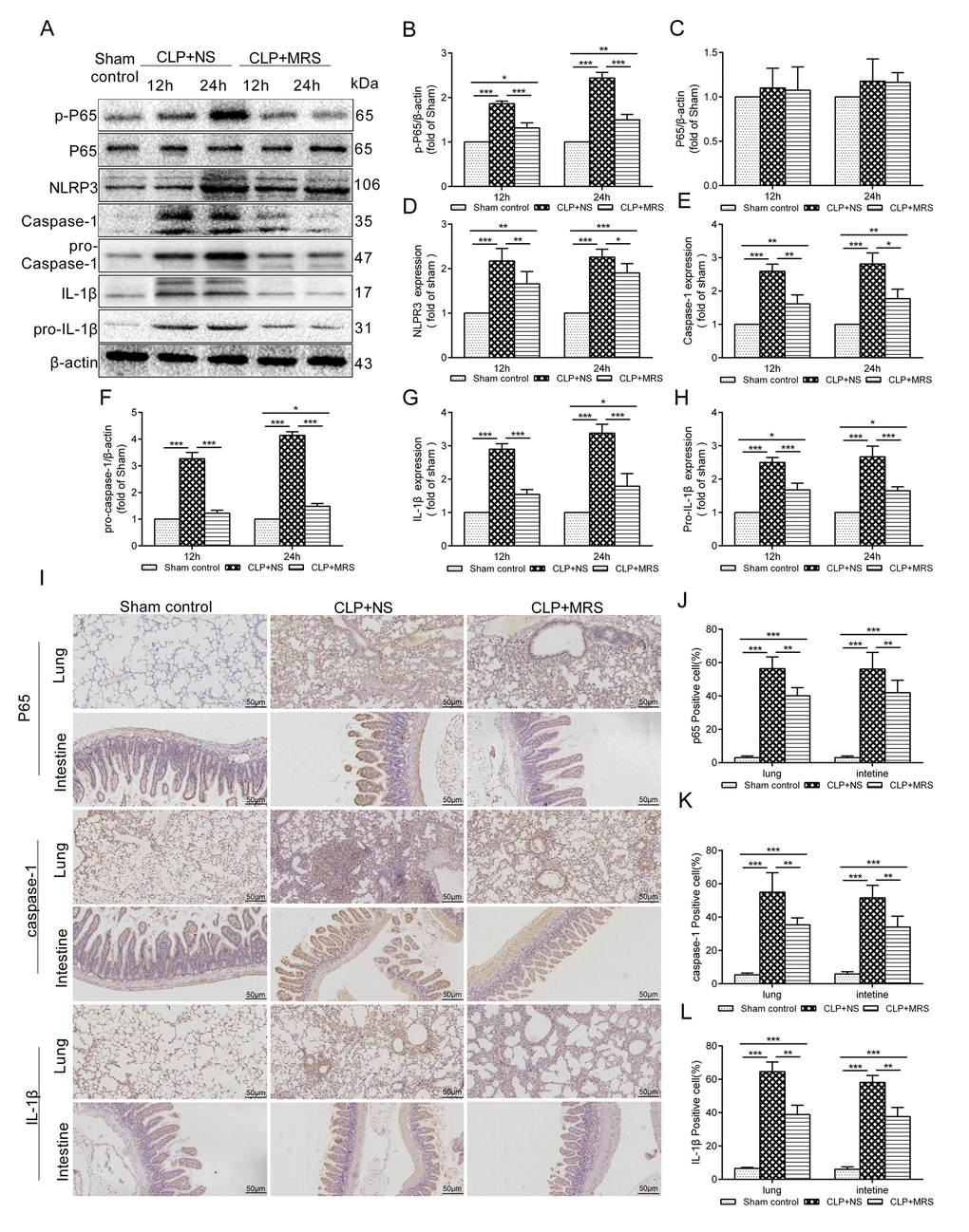 Methane-rich saline downregulated the NLRP3/Caspase-1/IL-18, IL-1β signaling pathway. The lung tissues were harvested 12 and 24 h after cecal ligation and puncture (CLP). (A) Representative immunoblots of p-p65, p65, pro-Caspase-1, pro-IL-1β and NLRP3/Caspase-1/ IL-1βfrom lung tissues 12 and 24h after MRS treatment. Relative densities of (B) p-P65. (C) P65. (D) NLRP3. (E) caspase-1. (F) pro-caspase-1. (G) IL-1β. (H) pro-IL-1β were calculated. (I) Representative immumohistochemical staining of P65, caspse-1 and IL-1β in the lung and intestine tissues. (J-L) The percentage of P65, caspse-1 and IL-1β positive cells were calculated. (Scale bars: 50μm. Data are shown as the mean ±SD. *P  **p ***P 
