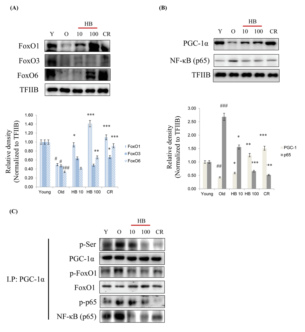 Caloric restriction (CR) and β-hydroxybutyrate (HB) increases FoxO1 activation during aging. Western blot analyses for renal nuclear (A) FoxO1, FoxO3, and FoxO6 as well as (B) PGC-1α and p65 were performed on nuclear proteins from rats treated with Young, Old, HB, and CR. Western blot results from 3 independent experiments were quantified by densitometry. #p ##p ###p *p **p ***p C) Nuclear extracts were prepared from kidneys from young and aged rat. Immunoprecipitation assay showed PGC-1α was physically associated with p-serine, p-FoxO1, FoxO1, p-p65, and p65.