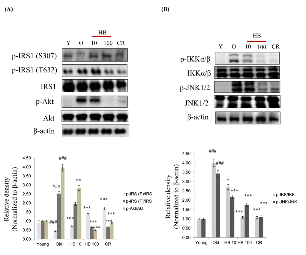 β-hydroxybutyrate (HB) decreases the expression of insulin signaling in aged rats. (A) Western blotting was performed to examine the protein levels of p-IRS-1 (Ser307), p-IRS-1 (Tyr632), IRS, p-Akt, and Akt as well as (B) p-IKK, IKK p-JNK, and JNK in the kidney of aged rats treated with HB. Three independent experiments were performed, and similar results were obtained. Western blot results from 3 independent experiments were quantified by densitometry. ###p *p **p ***p 