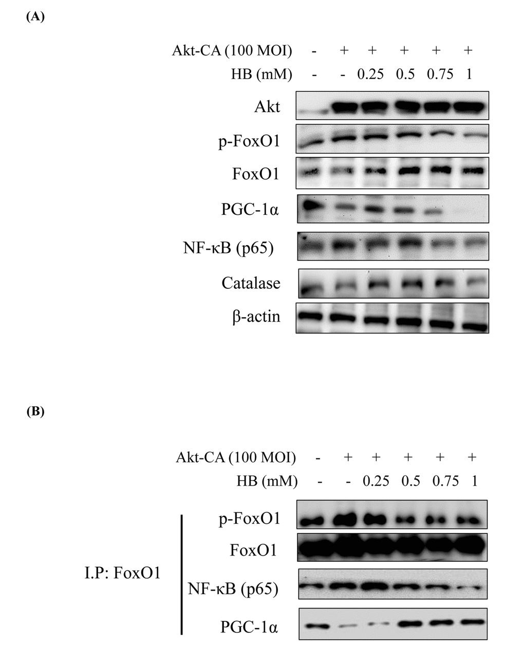 β-hydroxybutyrate (HB) regulates the activation of FoxO1 phosphorylation through the PI3K/Akt pathway. HEK293T cells were grown to 80% confluency in 100 mm dishes in DMEM medium, pre-treated (1 day) with or without CA-Akt (100 MOI), and then treated with 0.25–1 mM HB. (A) Cells were pre-transduced in the absence or presence of CA-Akt vector (100 MOI), and analyzed by western blotting. (B) Immunoprecipitation showed that FoxO1 was physically associated with phosphorylated FoxO1, FoxO1, p65, and PGC-1α after stimulation with HB (0.25–1 mM) in the absence or presence of CA-Akt (100 MOI).