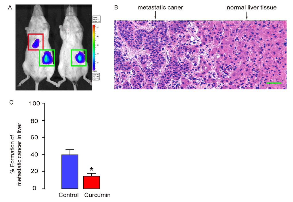 Curcumin reduces metastatic tumor formation in liver of s.c. grafted PGCs. (A-C) The formation of metastatic tumor in liver was assessed 12 weeks after transplantation in mice. (A) Representative images showing a positive and a negative case by bioluminescence in liver area. (B) A representative histological image showing metastatic cancer or normal liver. (C) Ratio of formation of metastatic tumor in liver. *p