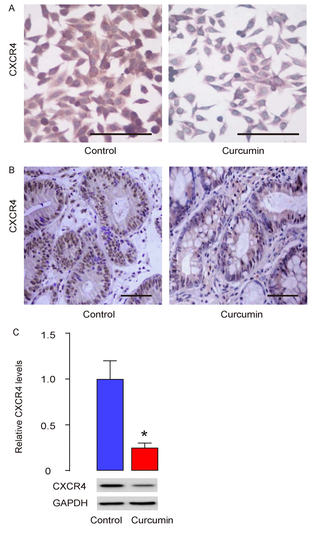 Curcumin inhibits liver metastasis of GC through CXCR4. (A) Cultured PGCs were treated with/without 0.5µmol/l Curcumin for 12 hours and then stained for CXCR4. (B) CXCR4 levels were also assessed in the formed tumor by s.c. PGC grafting in mice that had received Curcumin or control, by immunostaining (B), and by Western blotting (C). *p