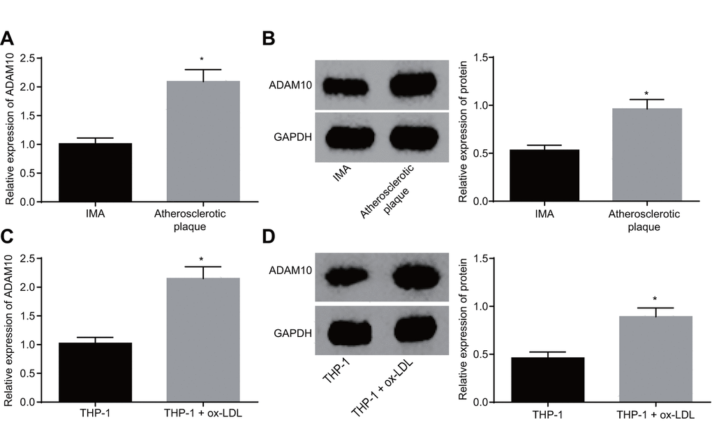 ADAM10 is upregulated in atherosclerosis. (A) RT-qPCR detects the transcriptional level of ADAM10 in atherosclerotic plaque and IMA tissues; n = 16; (B) the protein level of ADAM10 in atherosclerotic plaque and IMA tissues determined by Western blot analysis; n = 16; (C) RT-qPCR was used to detect the transcriptional level of ADAM10 in ox-LDL-exposed THP-1 macrophage-derived foam cells and THP-1 macrophages; (D) Western blot analysis was used to detect the protein level of ADAM10 protein in atherosclerotic plaque and IMA tissues;* p vs. the IMA tissues or THP-1 cells; the measurement data were expressed in the form of mean ± standard deviation and analyzed by unpaired t-test, the experiment was repeated 3 times; IMA, internal mammary artery; THP-1, the human monocytic leukemia cell line; ADAM10, A disintegrin and metalloprotease 10; RT-qPCR, reverse transcription quantitative polymerase chain reaction; CDKN, cell-dependent kinase inhibitor.