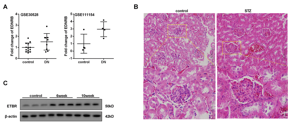 ETBR expression level was up-regulated in kidney tissue of DN. Ten weeks after the establishment of diabetic mice, the mice were sacrificed and kidneys were collected for further use. (A) mRNA levels of ETBR in kidney tissue from patients with DN (GEO database, GSE30528 and GSE111154) and healthy control. EDNRB, gene of ETBR. (B). HE staining of kidney tissue from STZ-diabetic mice and control mice was conducted to confirm the occurrence of diabetic nephropathy. (C). Protein level of ETBR in kidney tissue from STZ-diabetic mice at six and tenth weeks after the initial intraperitoneal injection of STZ. N=3.