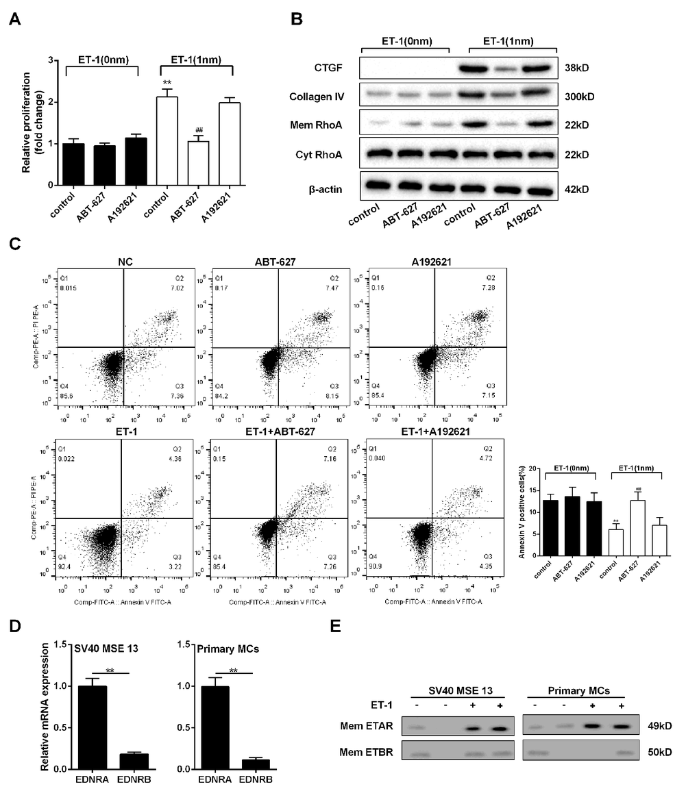 ET-1 promoted RhoA/ROCK pathway in mesangial cells through ETAR. Mesangial cells were treated with 1 nM ET-1, ABT-627(25μM, inhibitor of ETAR pathway) or A192621 (25μM, inhibitor of ETBR pathway) for 24 h. (A-C) Mesangial cell proliferation, RhoA/ROCK and ECM-related proteins, and cell apoptosis were detected in control, ABT-627, A192621, ET-1, ET-1+ ABT-627, ET-1+A192621 groups. **pD) Expression quantity from gene transcription level of EDNRA and EDNRB in mouse mesangial cells SV40 MSE 13 and mouse primary mesangial cells. **pE) ETAR and ETBR expressions on mesangial cell membrane were measured in ET-1 treated SV40 MSE 13 cells and primary mesangial cells. Bars depict the mean ± SD. N=3.