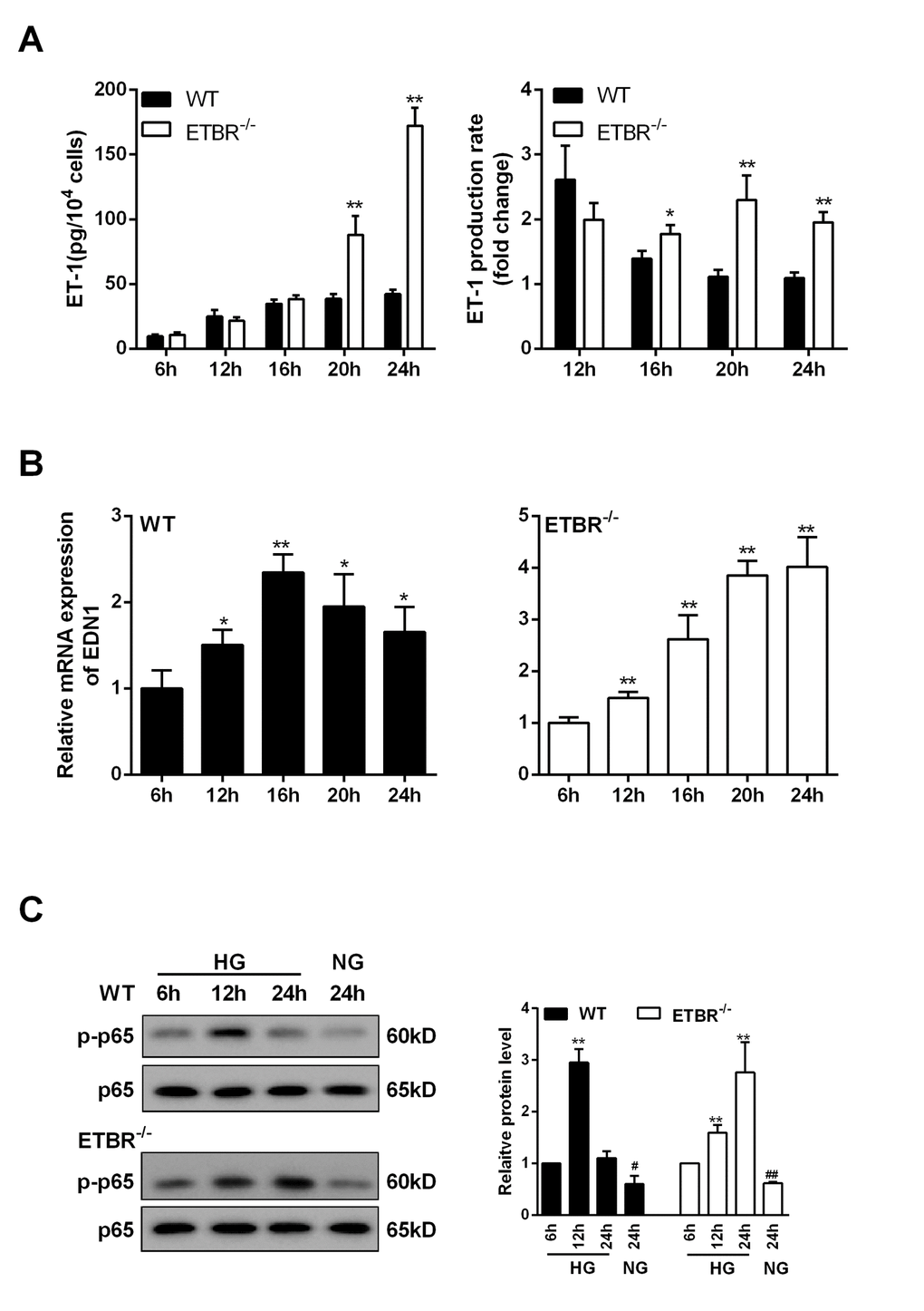 ET-1 was overexpressed in ETBR knockout GENs and was regulated by NF-kapapB pathway. GENs was cultured in HG medium, and the supernatant and GENs were collected at 6 h, 12 h, 16 h, 20 h, 24 h after cultivation. (A) Under the HG condition, ET-1 expression (in the supernatant)in WT and ETBR knockout GENs groups was detected at 6 h, 12 h, 16 h, 20 h, 24 hGENGEN . **pB) mRNA expressions of EDN1 in WT GENs and ETBR-/- GENs groups were detected at 6 h, 12 h, 16 h, 20 h, 24 h. **p-/- GENs within 24 h. **pC) Protein levels of p-p65 in WT GENs and ETBR-/- GENs groups were measured at 6 h, 12 h, 16 h, 20 h, 24 h. Bars depict the mean ± SD. N=3.
