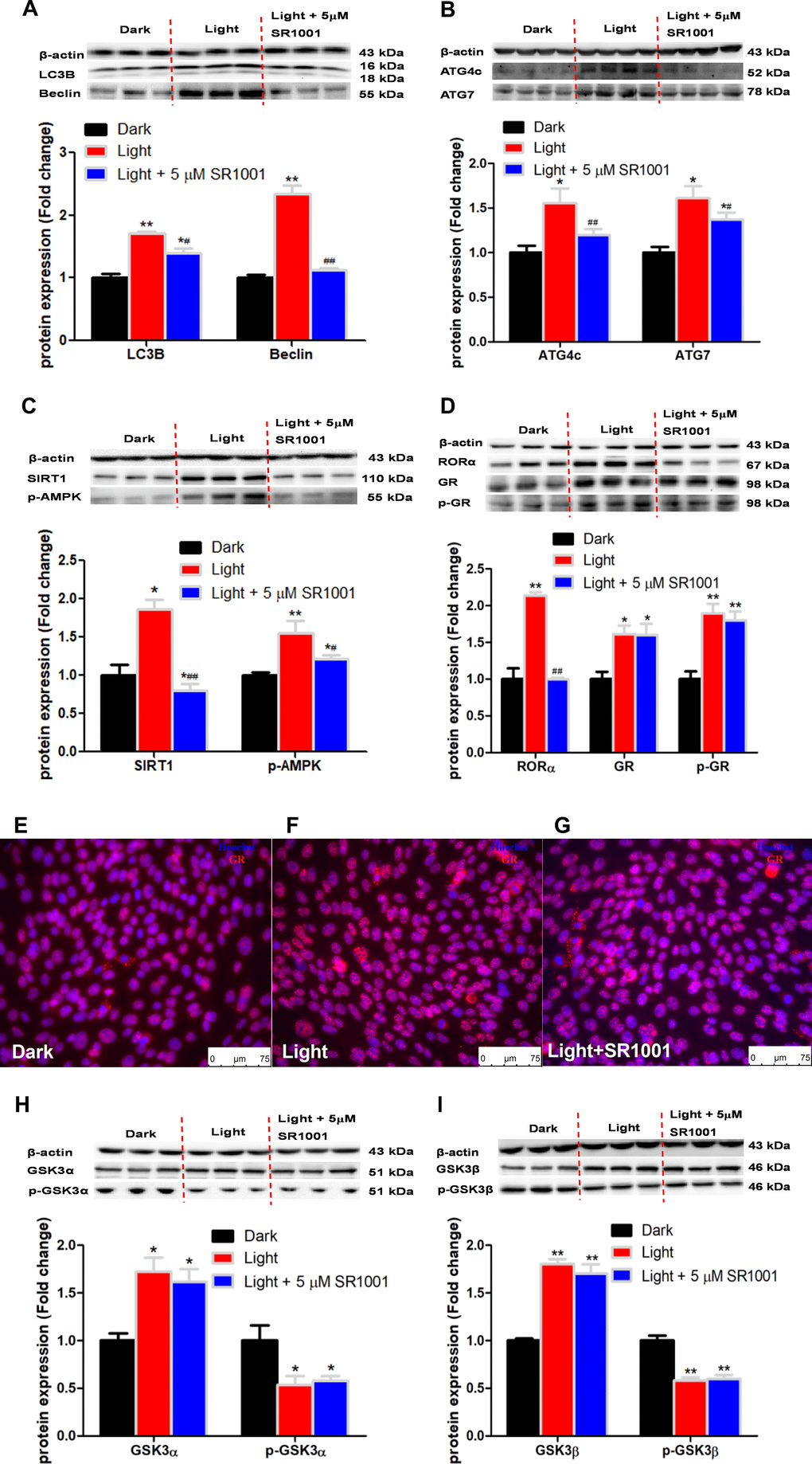 RORα inhibitor, SR1001, rescues the expression of autophagy-related proteins, yet not GSK3α, GSK-3β and GR in light-exposed HT-22 cells. (A–D) Protein content of LC3B, Beclin, ATG4c, ATG7, SIRT1, phospho-AMPK, RORα, GR and phospho-GR. RORα inhibitor SR1001 completely rectified light-induced up-regulation of RORα and autophagy-related proteins, including LC3B, Beclin, ATG4c, ATG7, SIRT1 and phospho-AMPK, in HT-22 cells. However, increases in GR and phospho-GR protein expression were not rectified by SR1001. Values are means ± SEM, *p p #p ##p E–G) Immunofluorescence of GR, showing that SR1001 was not able to restore light-induced GR activation and GR nuclear translocation. The nuclei were stained with Hoechst (blue) and GR was stained with GR antibody (red). Scale bars, 75 μm; (H–I) Protein content of total and phospho-GSK-3α/β (Ser21/9). Light-induced increase in total GSK-3α/β and decrease in phospho-GSK-3α/β were not rescued by SR1001. Values are means ± SEM, *p p 