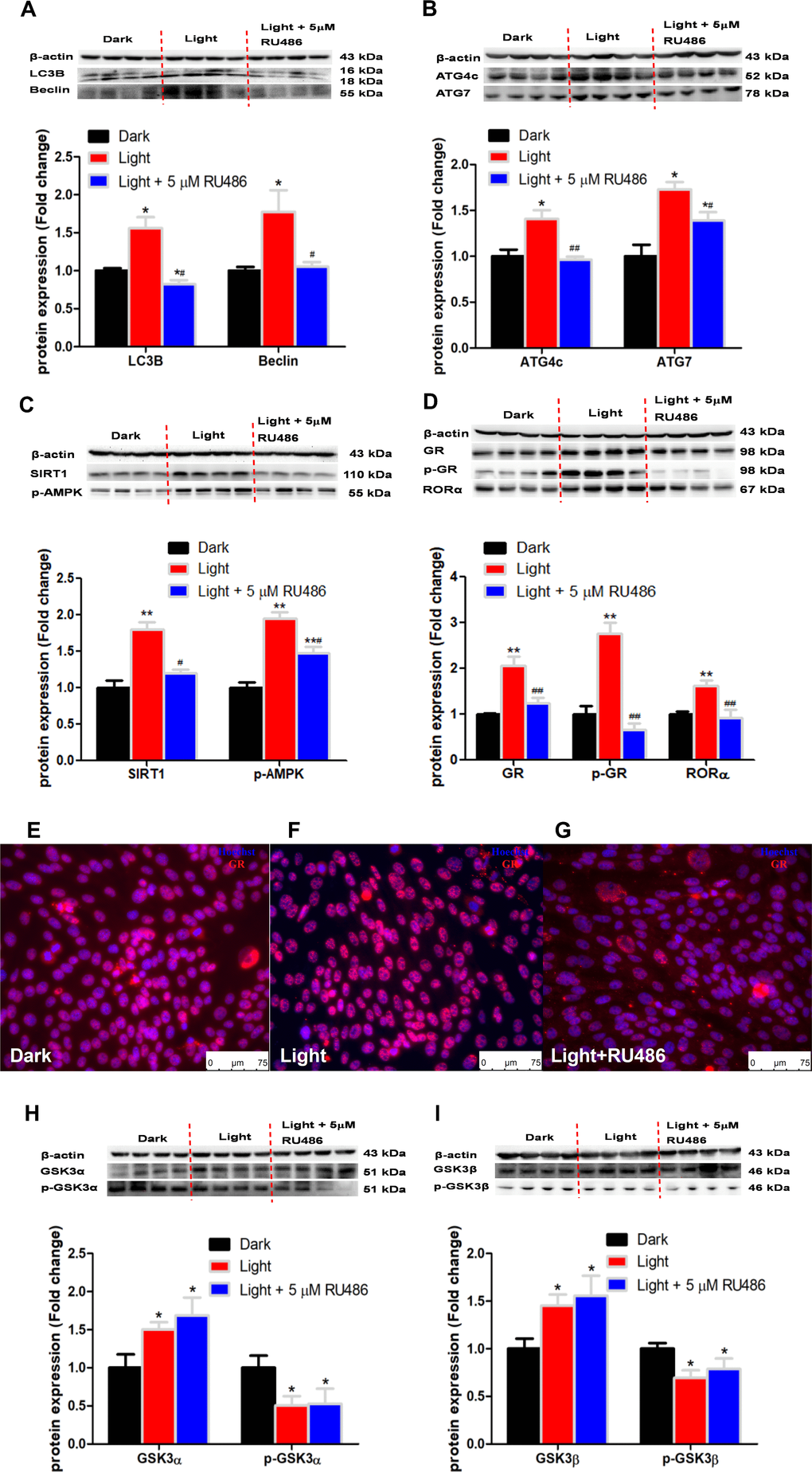 GR inhibitor, RU486, rescues the expression of autophagy-related proteins and nuclear receptor RORα expression, yet not GSK3α and GSK-3β in light exposure cells. (A–D) Protein content of LC3B, Beclin, ATG4c, ATG7, SIRT1, phospho-AMPK, RORα, GR and phospho-GR. GR inhibitor RU486 completely rectified light-induced up-regulation of GR, phospho-GR, RORα and autophagy-related proteins, including LC3B, Beclin, ATG4c, ATG7, SIRT1 and phospho-AMPK, in HT-22 cells. Values are means ± SEM, *p p #p ##p E–G) Immunofluorescence of GR, showing that RU486 was able to restore light-induced GR activation and GR nuclear translocation. The nuclei were stained with Hoechst (blue) and GR was stained with GR antibody (red). Scale bars, 75 μm; (H–I) Protein content of total and phospho-GSK-3α/β (Ser21/9). Light-induced increase in total GSK-3α/β and decrease in phospho-GSK-3α/β were not rescued by RU486. Values are means ± SEM, *p 