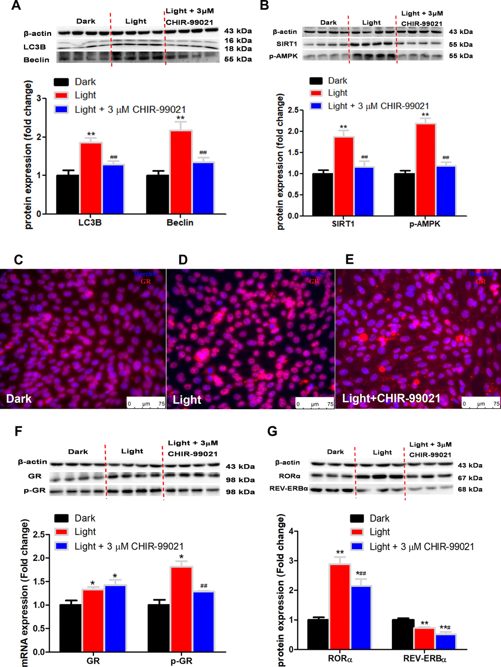 GSK3 inhibitor, CHIR-99021, rescues the expression of autophagy-related proteins and nuclear receptor GR, RORα expression in light exposure cells. (A–B) Protein content of LC3B, Beclin, SIRT1 and phospho-AMPK. GSK3 inhibitor CHIR-99021 completely rectified light-induced up-regulation of autophagy-related proteins, including LC3B, Beclin, SIRT1 and phospho-AMPK, in HT-22 cells. Values are means ± SEM, **p ##p C–E) Immunofluorescence of GR, showing that CHIR-99021 was able to restore light-induced GR activation and GR nuclear translocation. The nuclei were stained with Hoechst (blue) and GR was stained with GR antibody (red). Scale bars, 75 μm; (F–G) Protein content of GR, phospho-GR, RORα and REV-ERBα. CHIR-99021 significantly alleviated light-induced increase of phospho-GR and RORα protein expression, yet the increase of total GR and the decrease of REV-ERBα in Light group were not restored. Values are means ± SEM, *p p #p ##p 