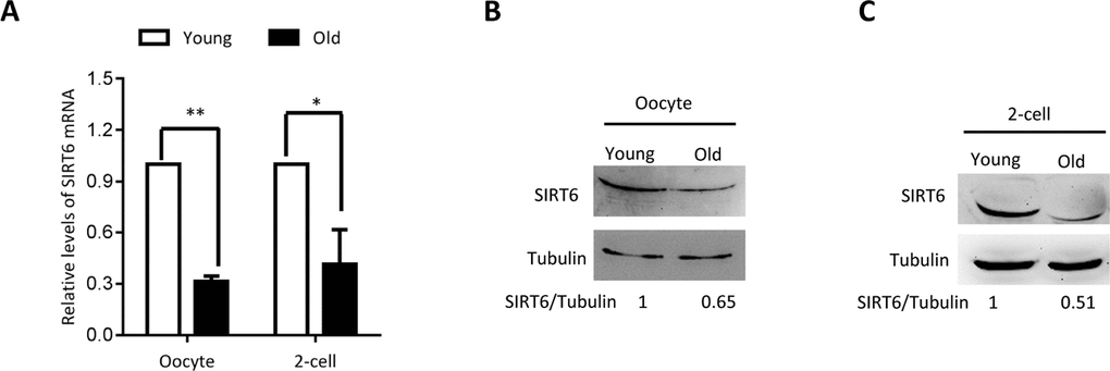 SIRT6 expression in aged mouse oocytes and embryos. Fully-grown oocytes and two-cell embryos from young and aged mouse were collected to evaluate SIRT6 expression. (A) Quantitative RT-PCR showing the lowered SIRT6 mRNA levels in aged oocytes and two-cell embryos. (B–C) SIRT6 protein expression in aged oocytes and two-cell embryos was verified by immunoblotting. Tubulin served as a loading control. Band intensity was calculated using ImageJ software, and the ratio of SIRT6/tubulin expression was normalized and values are indicated. Data are expressed as mean percentage ± SD of three independent experiments. *P 