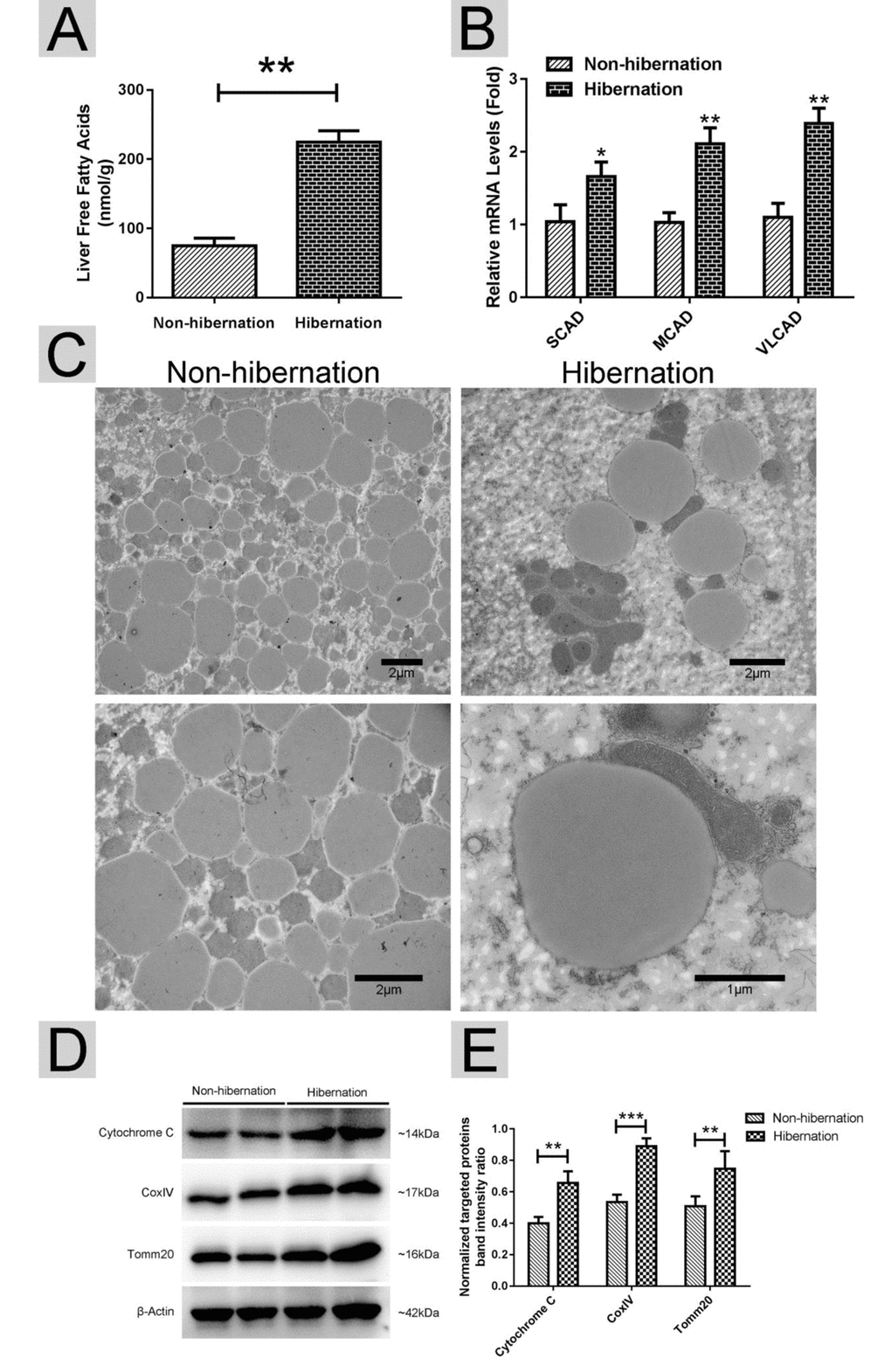 Lipolysis was stimulated during hibernation. (A) Contents of non-esterified free fatty acids (NEFAs) in the liver; (B) The mRNA expression of regulatory enzymes for mitochondrial β-oxidation (SCAD, MCAD and VLCAD); (C) Transmission electron microscopy (TEM) image of hepatocytes; (D) Western blotting analysis of mitochondrial markers (Cytochrome C, Cox IV and Tomm20); (E) Statistics of the western blotting results.