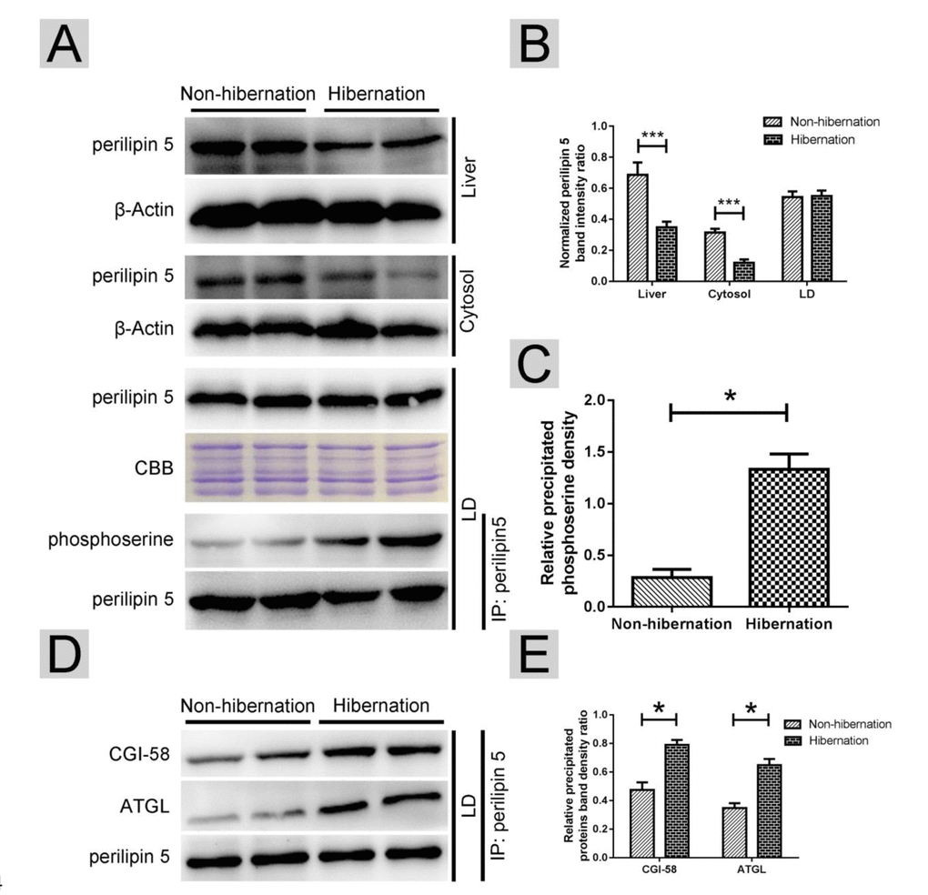 Phosphorylation of perilipin-5 on LD induced CGI-58-mediated regulation of ATGL activity. (A) Western blotting analysis of perilipin 5 protein expression and perilipin 5 phosphorylation; (B) Statistics of perilipin 5 protein expression in the liver, LDs and cytosol; (C) Statistics of perilipin 5 phosphorylation in LDs; (D) Analysis of the CGI-58/ATGL-perilipin 5 interaction; (E) Statistics of precipitated proteins.