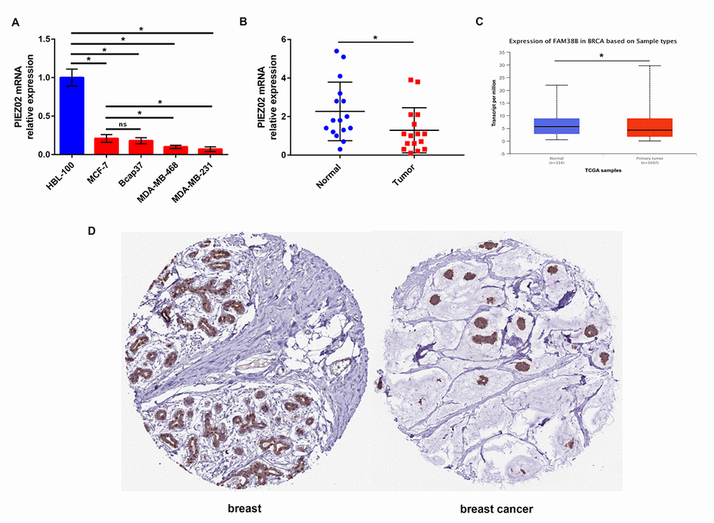 Expression of PIEZO2 in breast cancer. (A) PIEZO2 expression in breast cancer cell lines (MCF-7, Bcap37, MDA-MB-468 and MDA-MB-231) compared with that in normal breast cell line (HBL-100); (B) PIEZO2 expression in clinical breast cancer tissues compared with that in matched adjacent normal tissues (n=16); (C) expression of PIEZO2 (also known as FAM38B) in breast cancer compared with normal controls by analyzing UALCAN database; (D) PIEZO2 protein expression level in breast cancer tissue and normal breast tissue was analyzed using immunohistochemical staining from HumanProteinAtlas database. *P