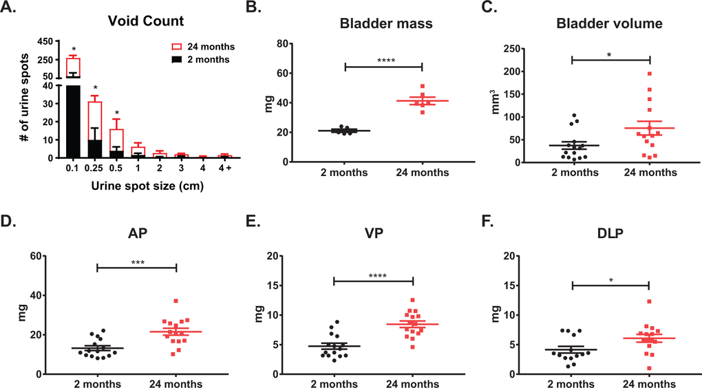 Lower urinary tract measurements show age related changes. (A) Aging mice show a significant increase in total urine spots as well as an increase in smaller urine spots as measured by void spot assay. (B) Aging significantly increases bladder mass. (C) Aging significantly increases bladder volume as calculated from caliper measurements. (D) Age significantly increases anterior prostate (AP) mass. (E) Aging significantly increases ventral prostate (VP) mass. (F) Aging significantly increases dorsolateral prostate (DLP) mass. *, p-value 