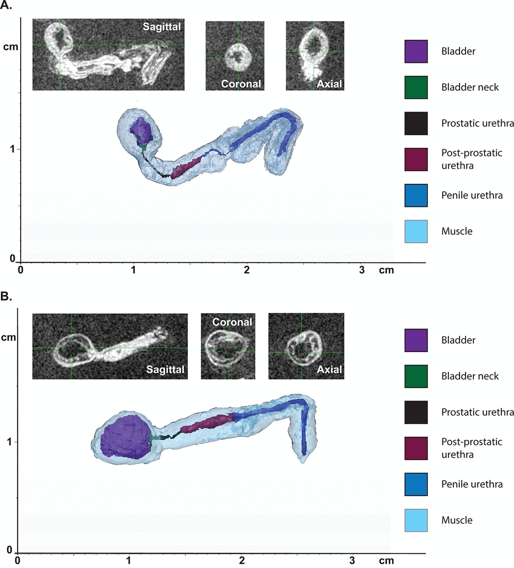 Aging leads to changes in urethral shape and area as measured by MRI. (A) Representative 3D reconstruction of the bladder and urethra from a young mouse. (B) Representative 3D reconstruction of the bladder and urethra from an aged mouse. Insets show MRI images in three planes used for the reconstruction.