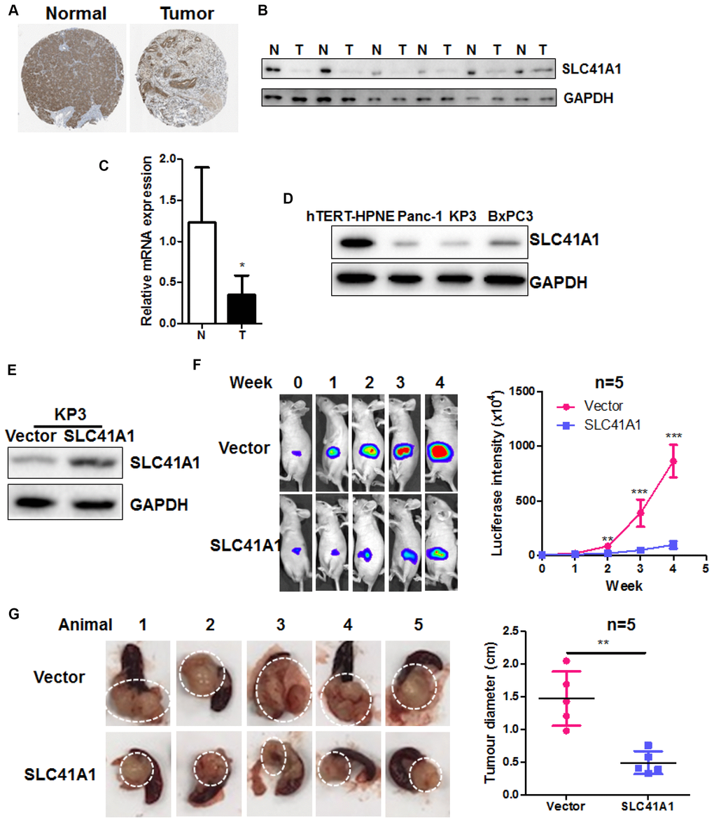 Overexpression of SLC41A1 suppresses tumour growth in an orthotopic mouse model of PDAC. (A) SLC41A1 protein was downregulated in human PDAC tissue. (B) SLC41A1 protein expression was suppressed in six PDAC tissue samples compared with paired non-adjacent pancreatic tissue. (C) SLC41A1 mRNA expression was suppressed in six PDAC tissues compared with paired non-adjacent pancreatic tissue. (D) Expression of SLC41A1 was downregulated in the human PDAC cell lines KP3, Panc-1, and BxPC3 compared with the normal pancreatic ductal epithelial cell line hTERT-HPNE. (E) Successful overexpression of SLC41A1 in KP3 cells that were used to create the orthotopic model (n = 5). (F) Overexpression of SLC41A1 suppressed the growth rate of orthotopic tumours in mice. (G) Tumour size was reduced by SLC41A1 overexpression. **p 